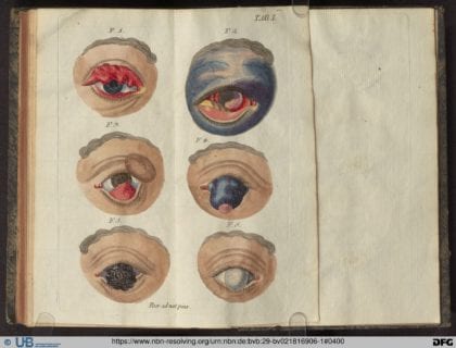Praktische Beobachtungen über verschiedene, vorzüglich aber über jene Augenkrankheiten, welche aus allgemeinen Krankheiten des Körpers entspringen, oder öfters mit denselben verbunden sind. - Wien : bey F.J. Kaiserer, 1790